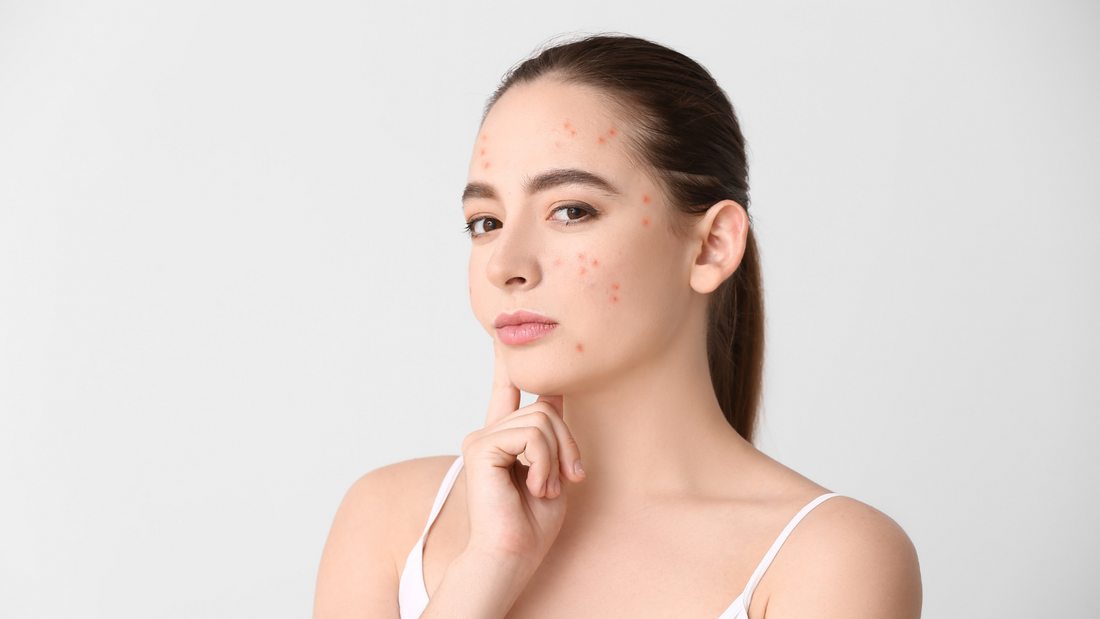 Unlock the Fountain of Youth: A Vibrant Guide to Age-Defying Skin