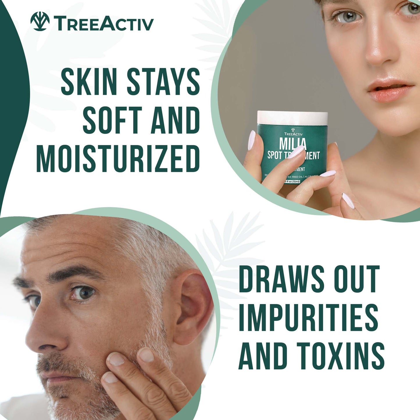 TreeActiv Milia Spot Treatment 0.5 fl oz