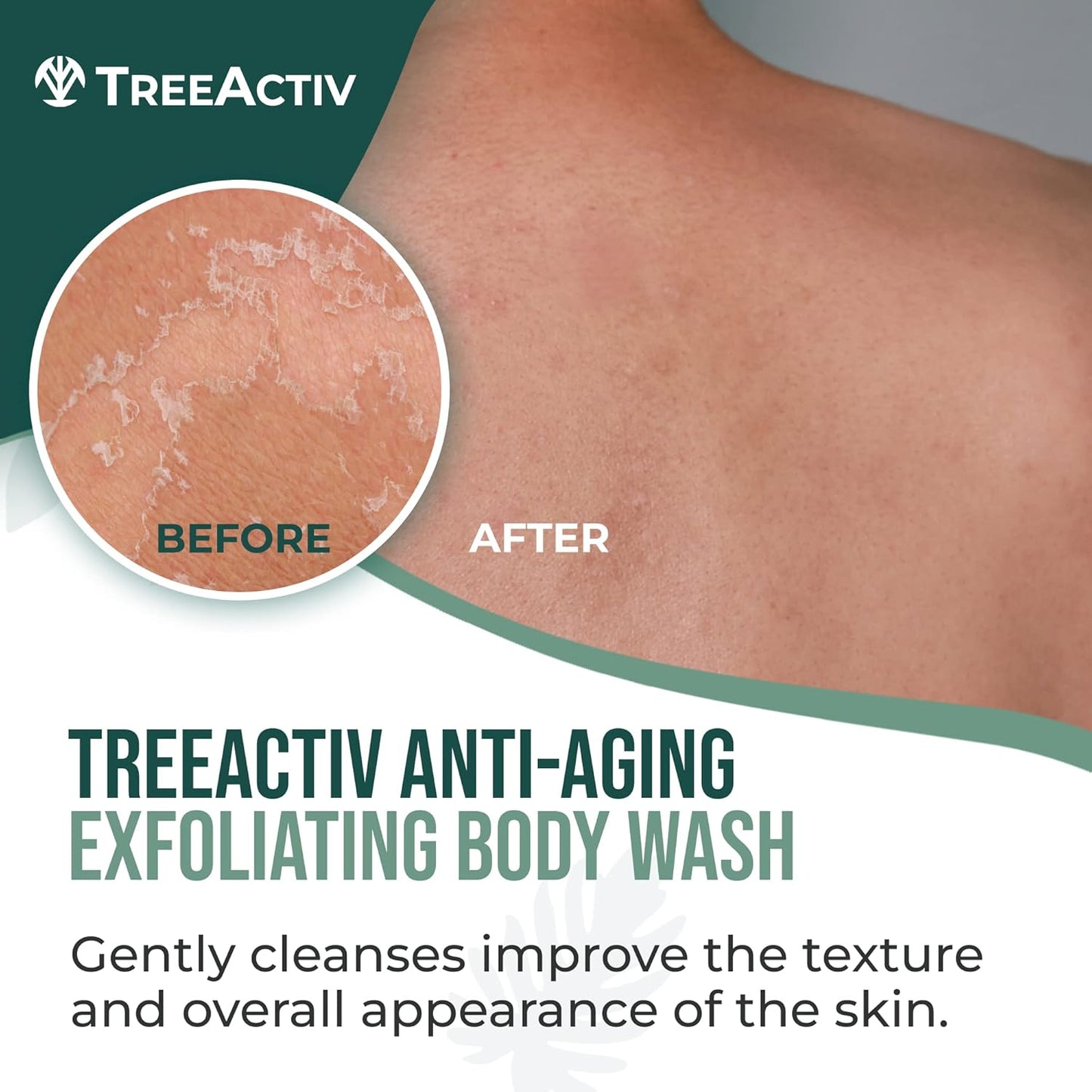 TreeActiv Anti Aging Body Wash 8 fl oz