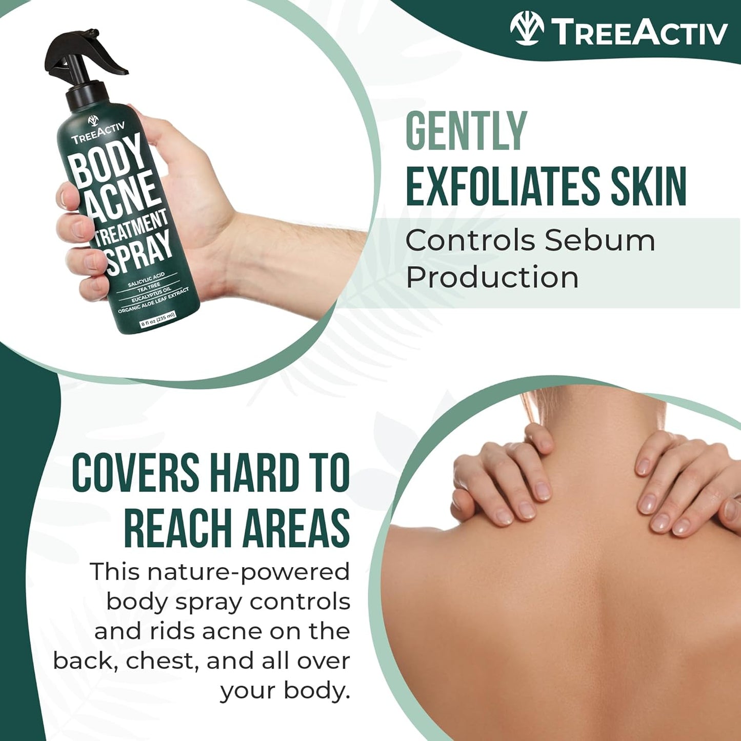 TreeActiv Acne Eliminating Body Spray 8 fl oz