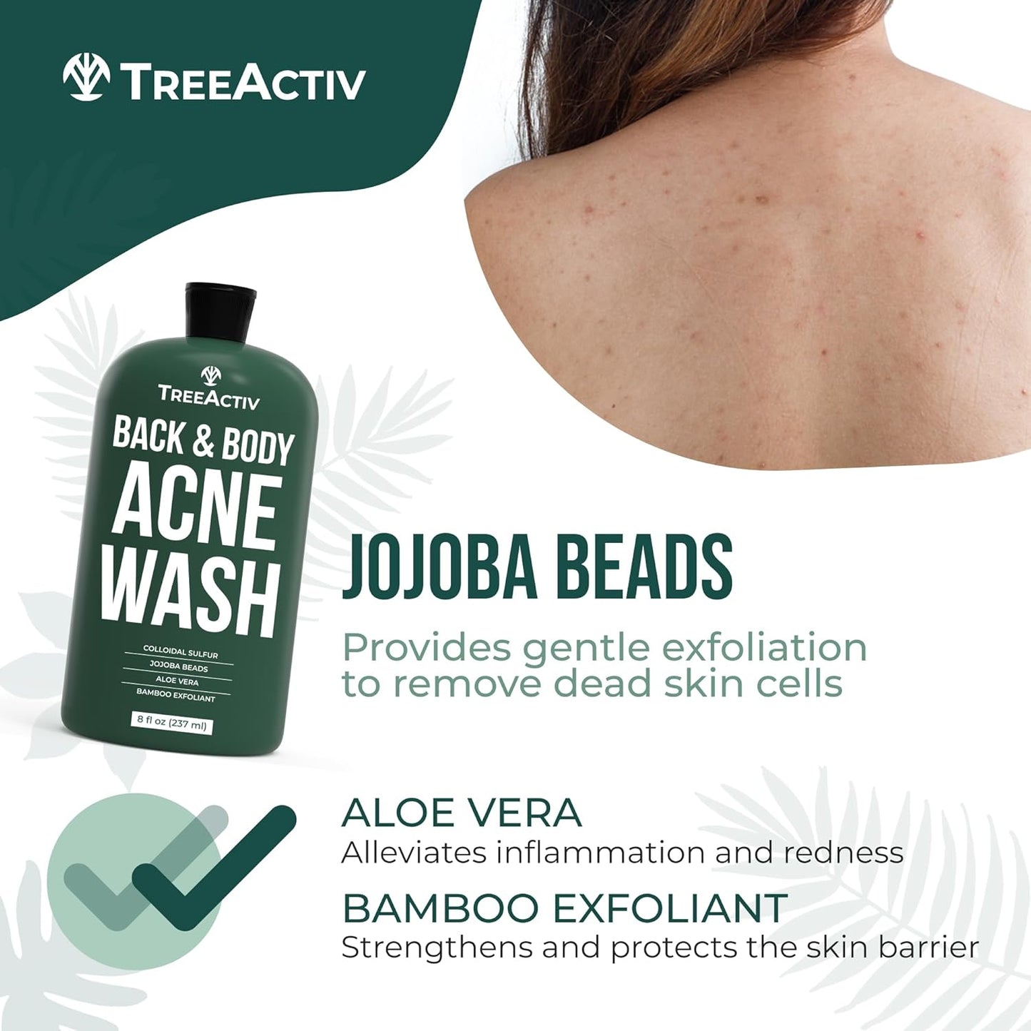 TreeActiv Anti-Acne Exfoliating Body Wash 8 fl oz