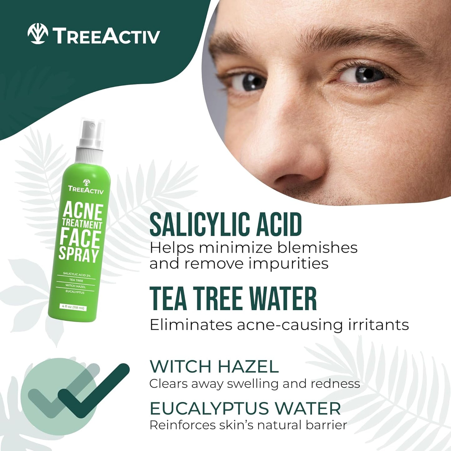 TreeActiv Acne Eliminating Face Spray 4 fl oz