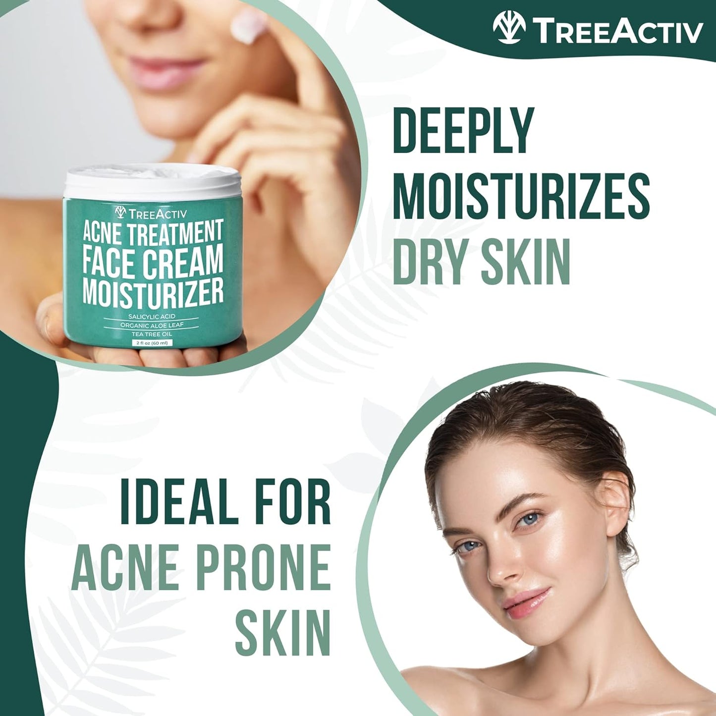 TreeActiv Acne Eliminating Face Cream 2 fl oz