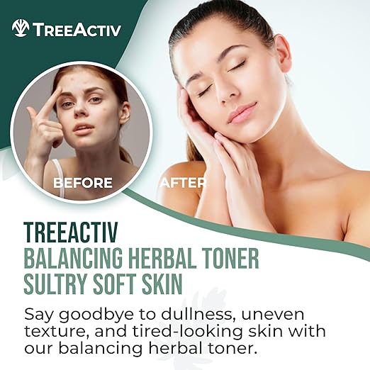 TreeActiv Balancing Herbal Toner 4 fl oz | Natural Skin pH Balancer