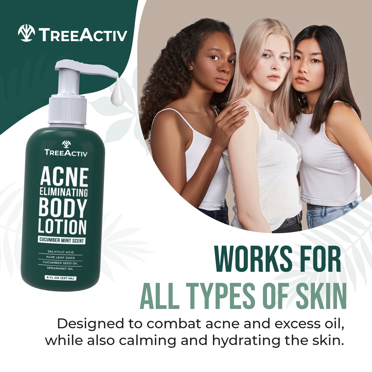 TreeActiv Acne Eliminating Body Lotion 8 fl oz | Clear Skin & Cucumber Mint Freshness