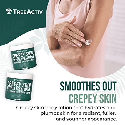 TreeActiv Crepey Skin Repair Treatment 8 fl oz | Firming Cream with Hyaluronic Acid