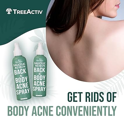 TreeActiv Acne Body Spray 4 fl oz (Pack of 2) | Severe Acne Body Spray - Gentle, Benzoyl Peroxide-Free Solution