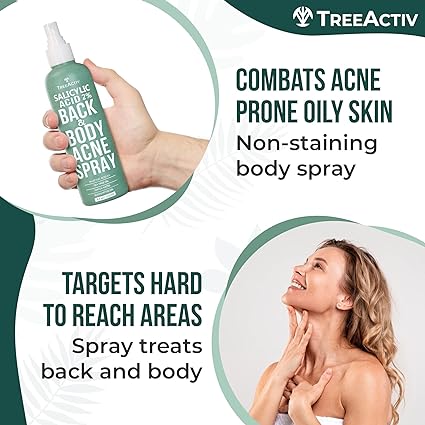 TreeActiv Acne Body Spray 4 fl oz (Pack of 2) | Severe Acne Body Spray - Gentle, Benzoyl Peroxide-Free Solution