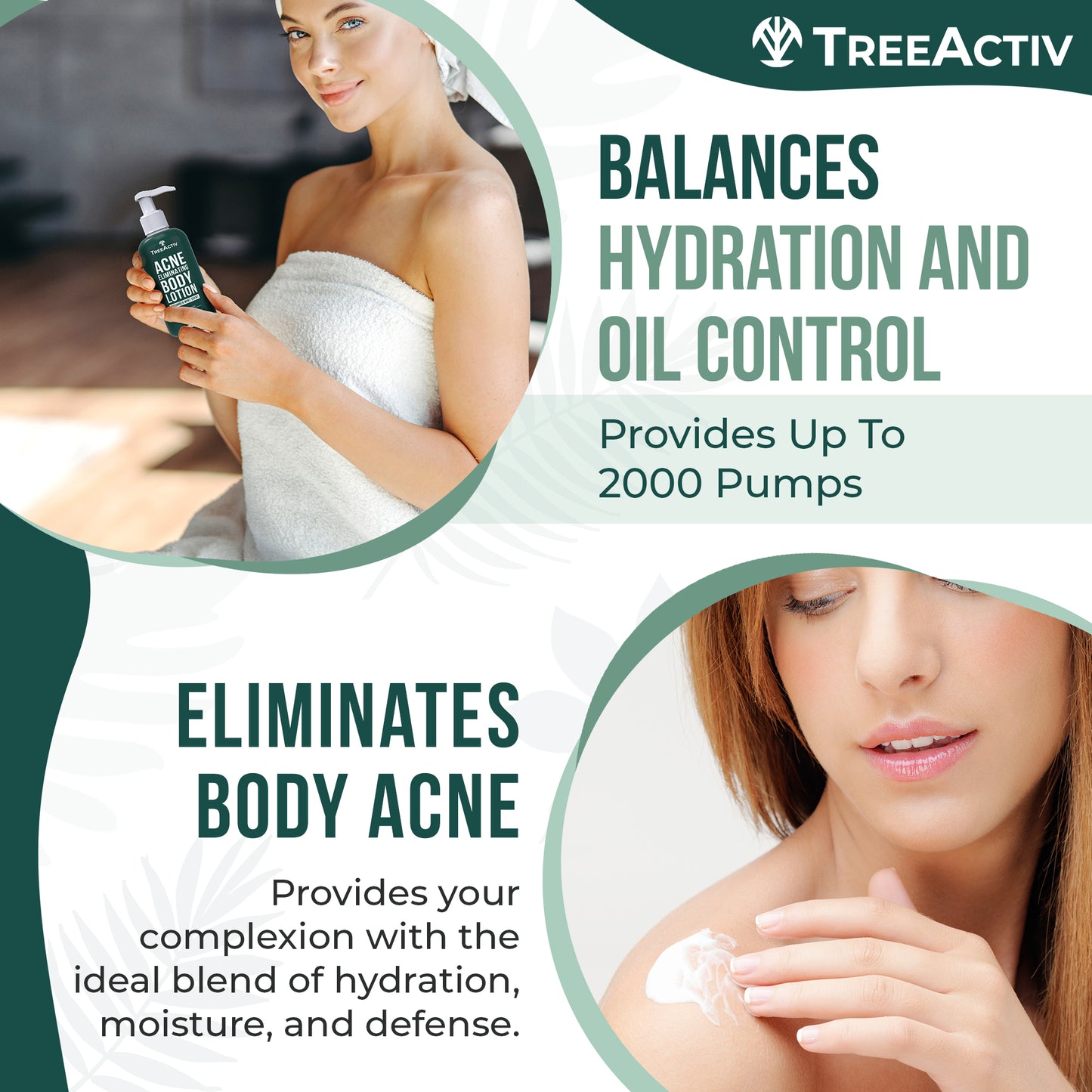 TreeActiv Acne Eliminating Body Lotion 8 fl oz | Clear Skin & Cucumber Mint Freshness