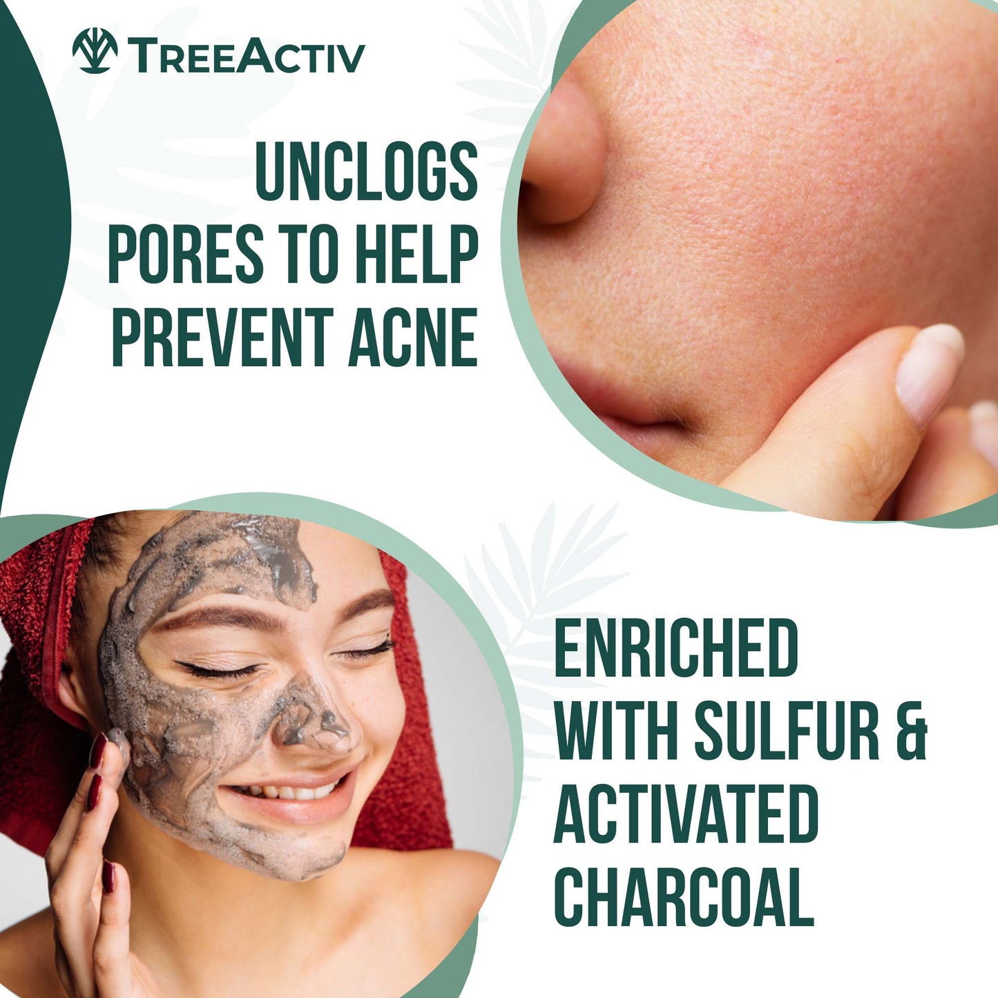 TreeActiv Charcoal Acne Face Wash 3.4 fl oz | Natural Cleanser for Clear, Smooth Skin