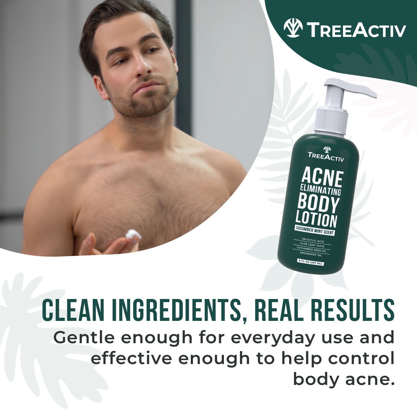 TreeActiv Acne Eliminating Body Lotion 8 fl oz | Clear Skin & Cucumber Mint Freshness