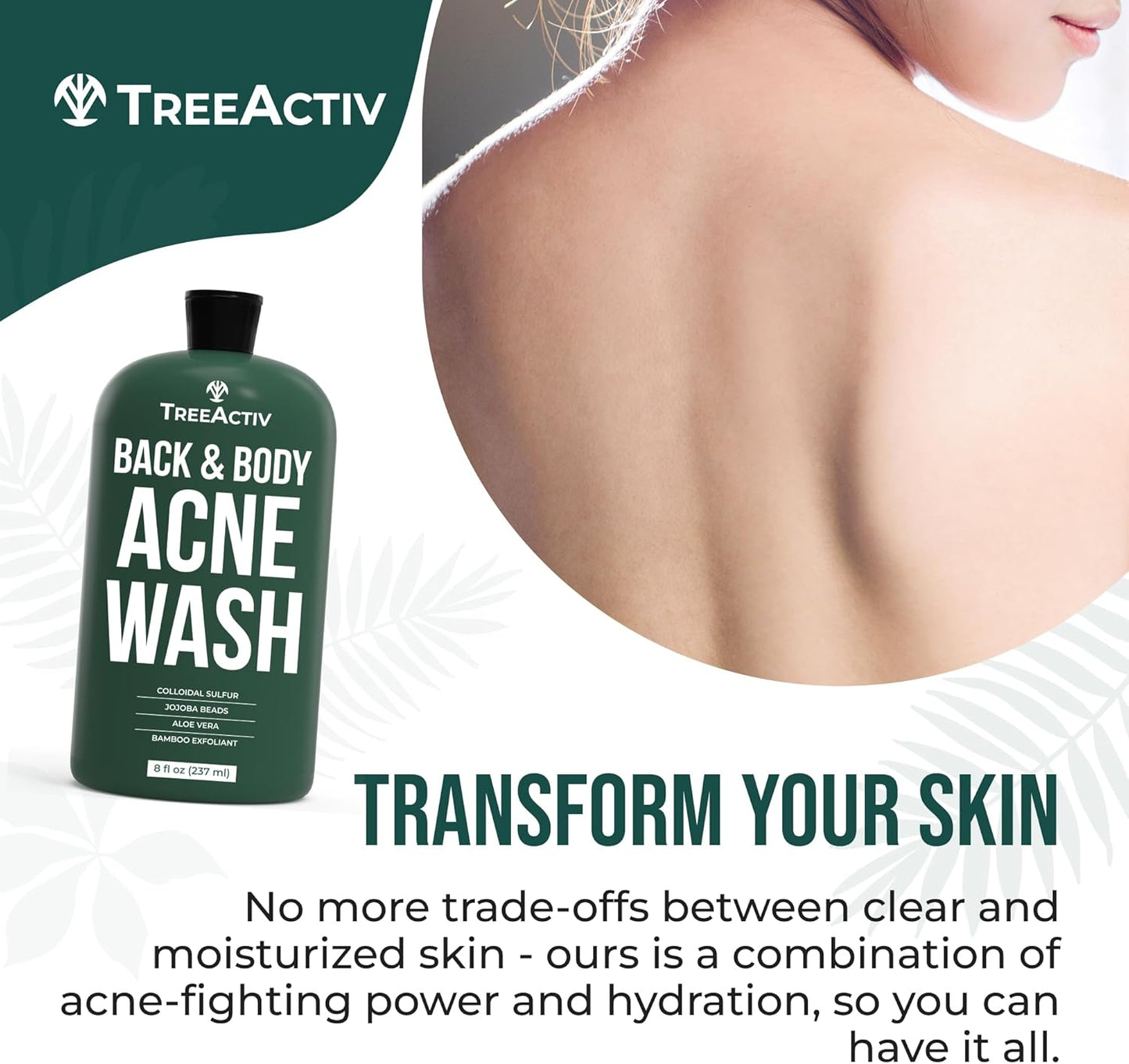 TreeActiv Anti-Acne Exfoliating Body Wash 8 fl oz