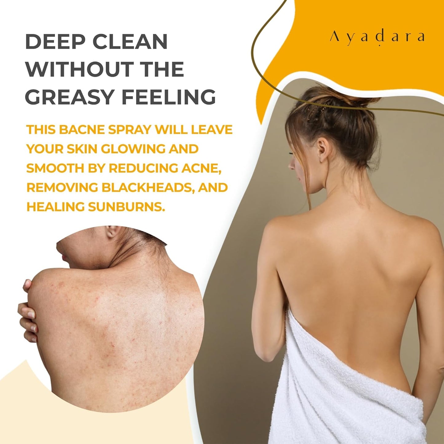 Ayadara Reverse Warrior Acne Treatment Body Spray 8 fl oz