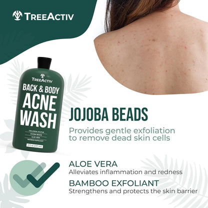 TreeActiv Anti-Acne Exfoliating Body Wash 8 fl oz
