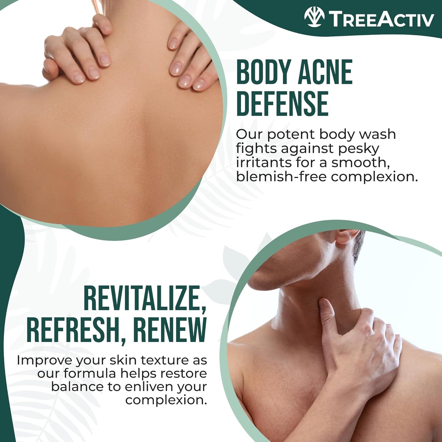 TreeActiv Anti-Acne Exfoliating Body Wash 8 fl oz