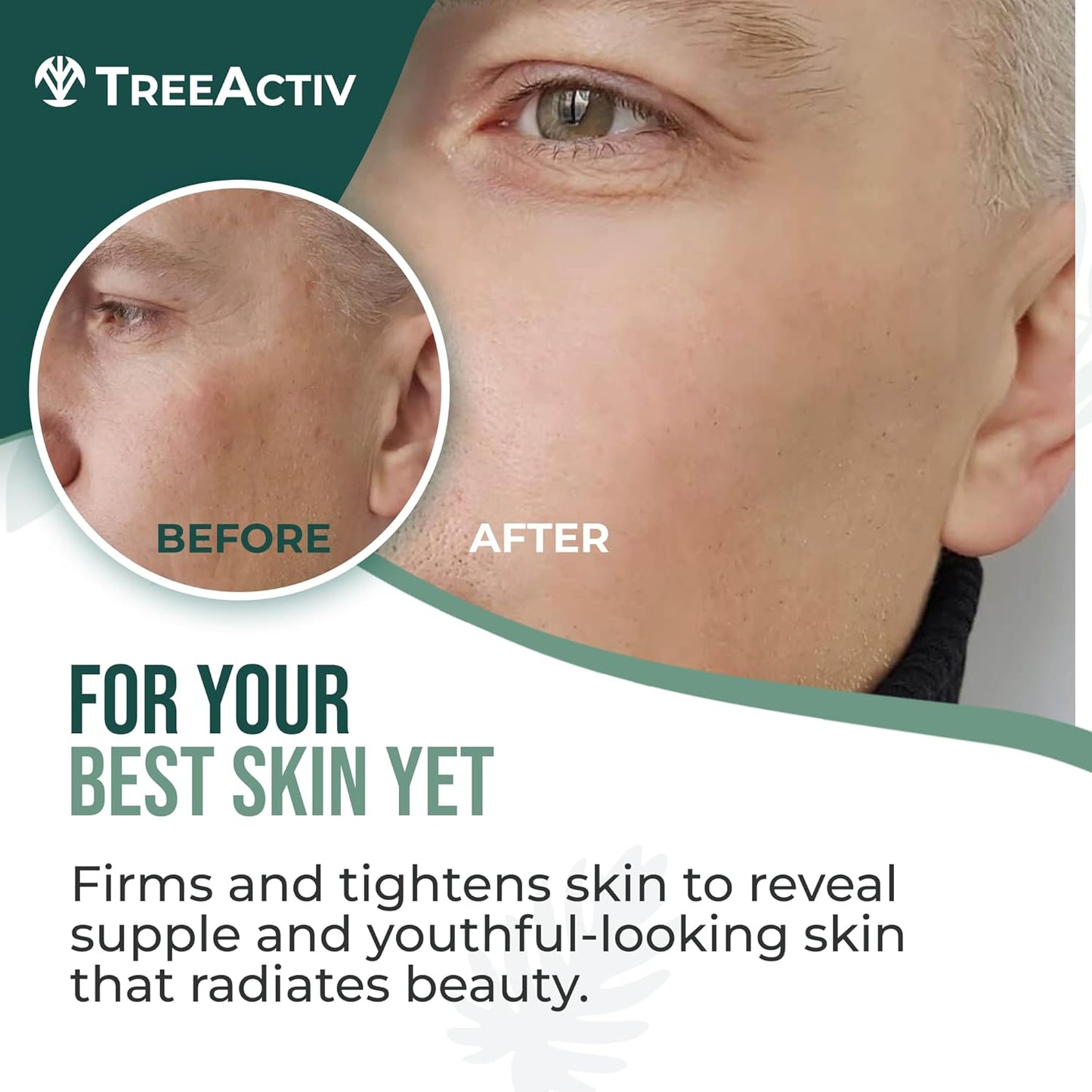 TreeActiv Retinol Cream 2 oz
