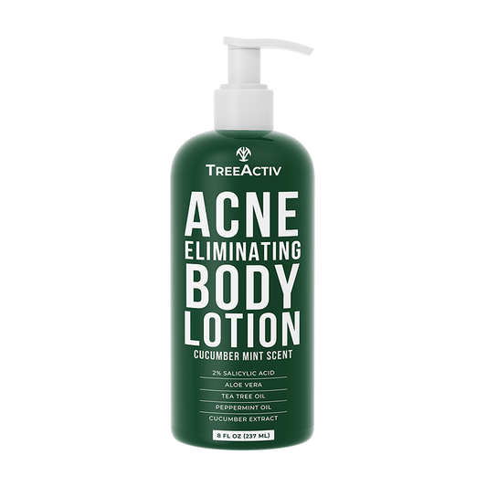 TreeActiv Acne Eliminating Body Lotion 8 fl oz