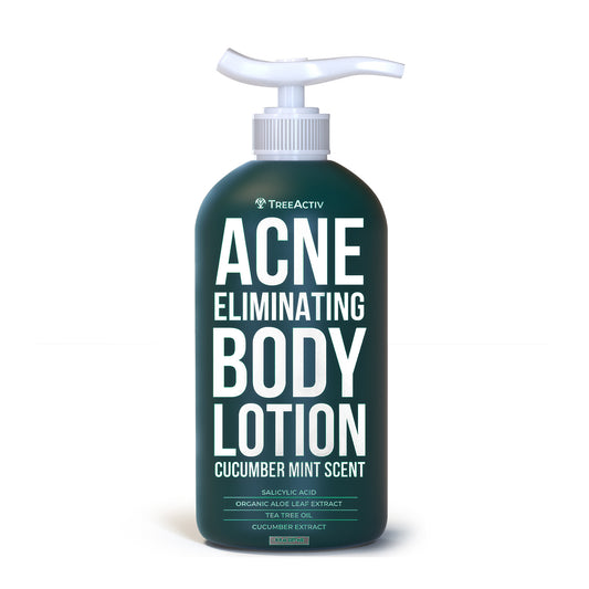 TreeActiv Acne Eliminating Body Lotion 8 fl oz | Clear Skin & Cucumber Mint Freshness